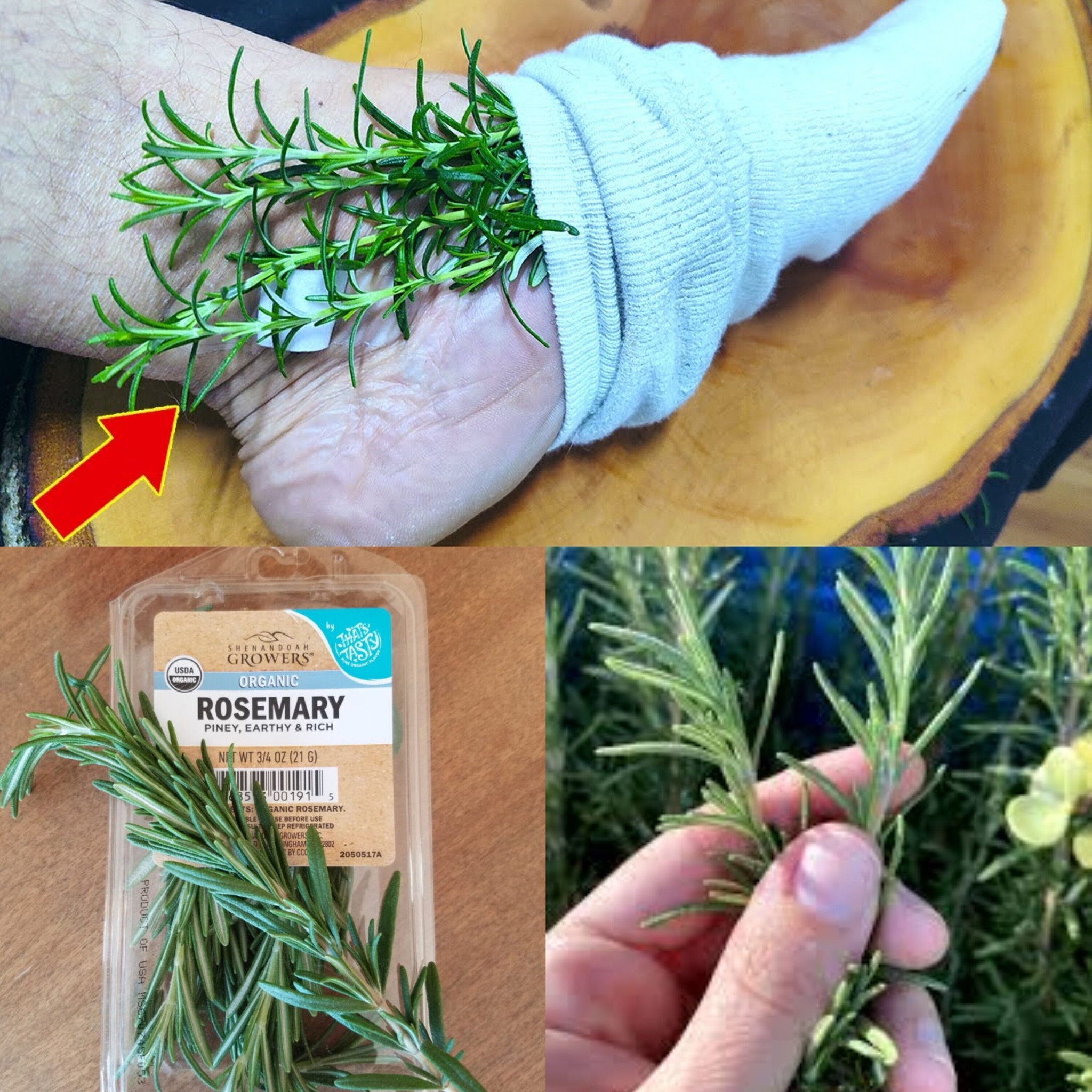 This Was the Solution: My Mother Could Not Walk Due to Varicose Veins and Leg Pain – Rosemary in the Socks