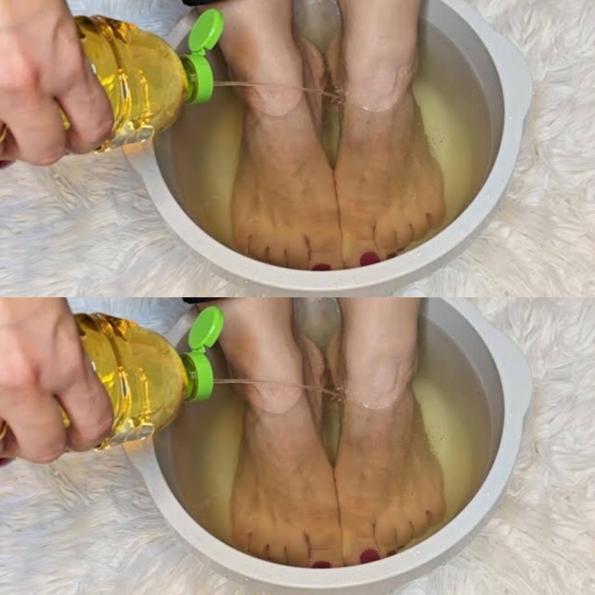 I Soaked My Feet in Apple Cider Vinegar and 15 Minutes Later I Was Shocked at What Happened! (Did You Know That?)