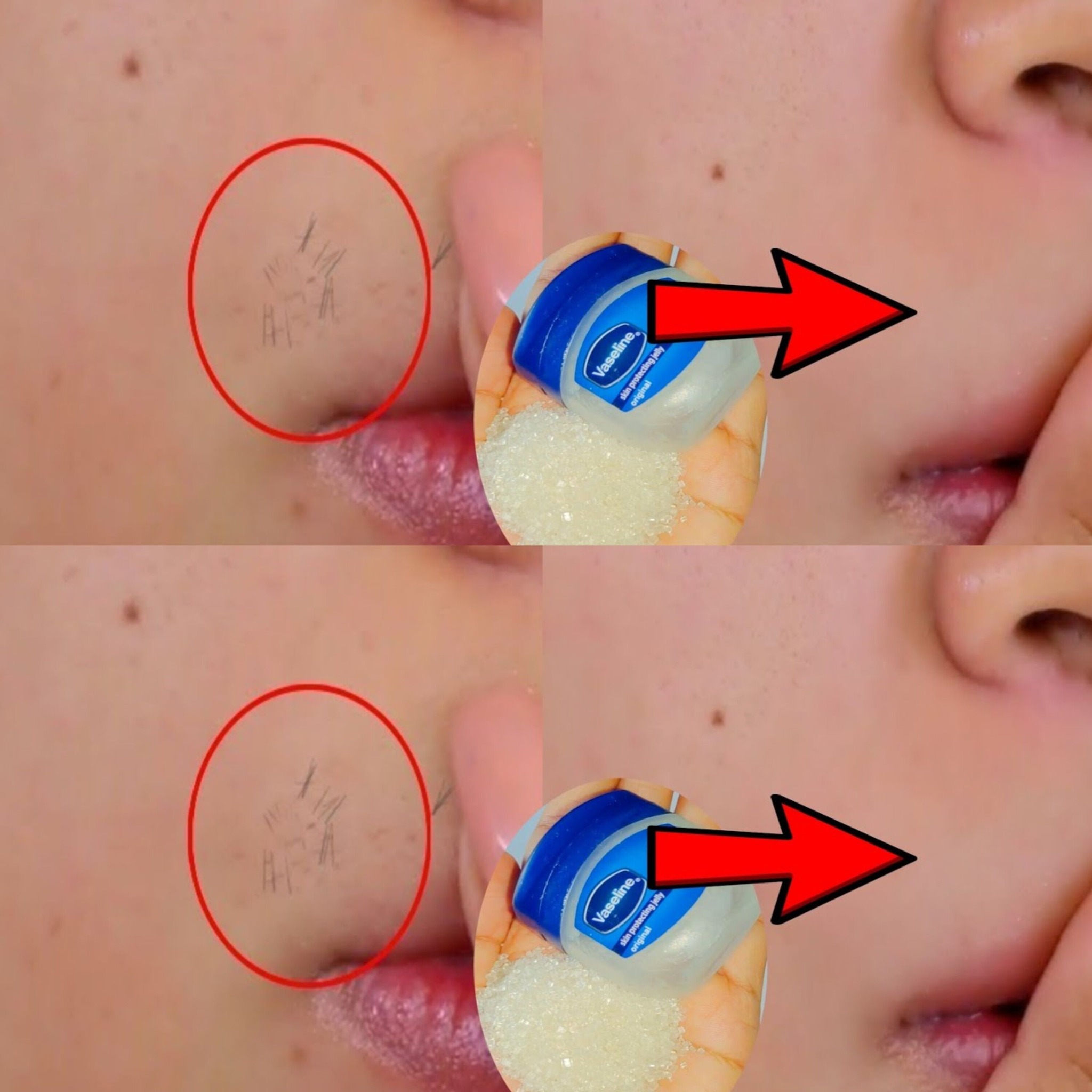 Vaseline for Upper Lip Hair Removal | Vaseline to Remove Facial Hair Permanently