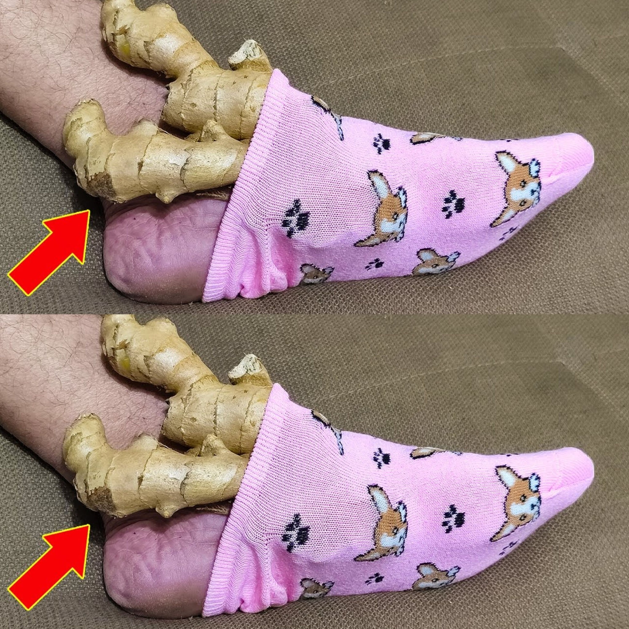 Put 1 Ginger on Your Feet and Stop Spending Money at the Pharmacy (Did You Know That?)