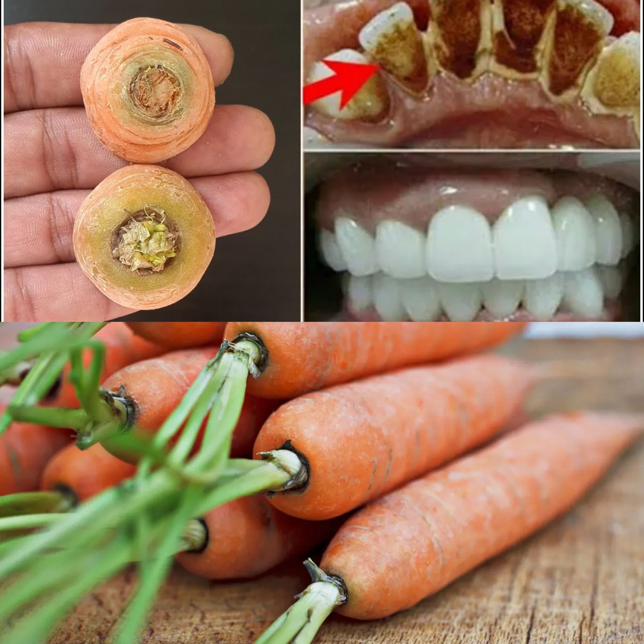 In 2 Minutes, Yellow Teeth Will Turn White Like Pearls with This Home Remedy Using Carrot Tops