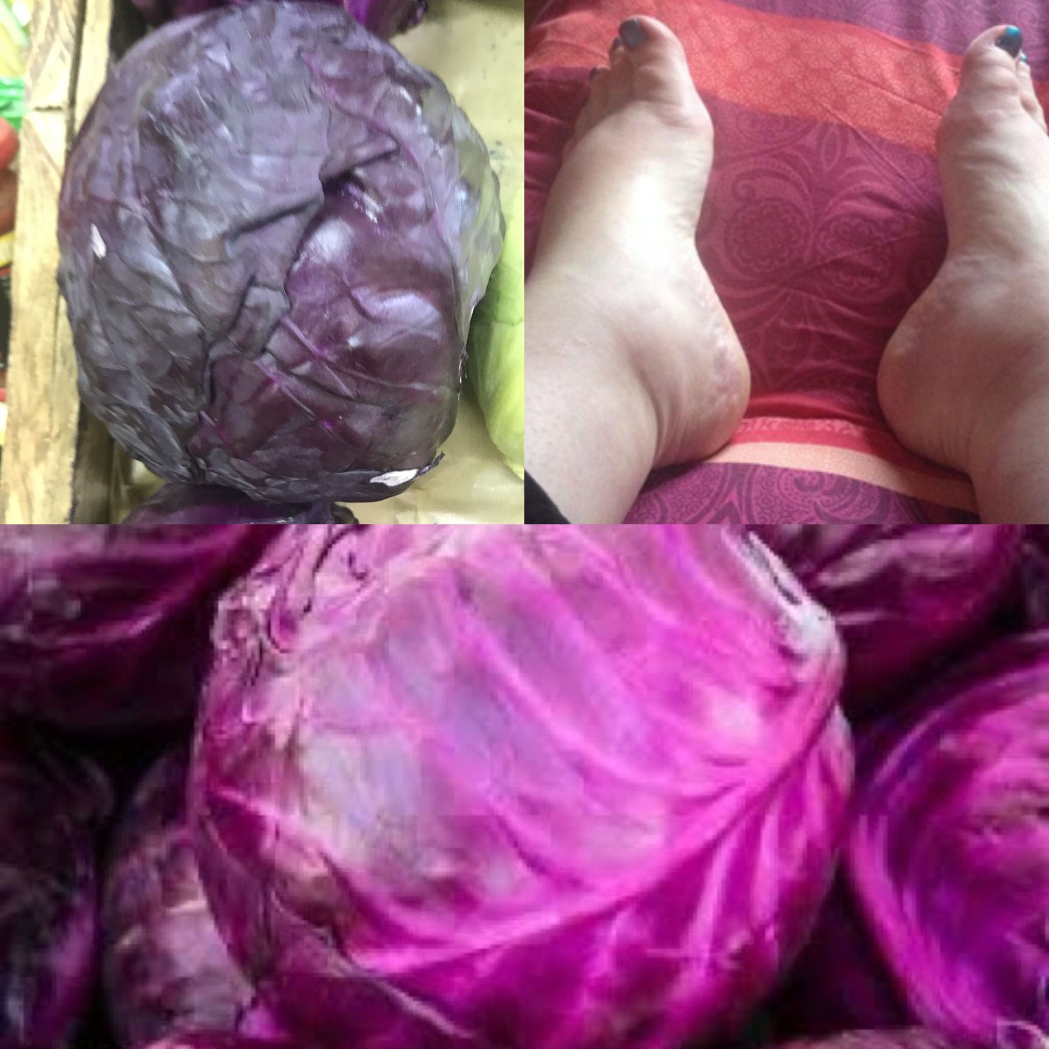 Kitchen Medicine: Purple Cabbage for Joint Swelling and Inflammation