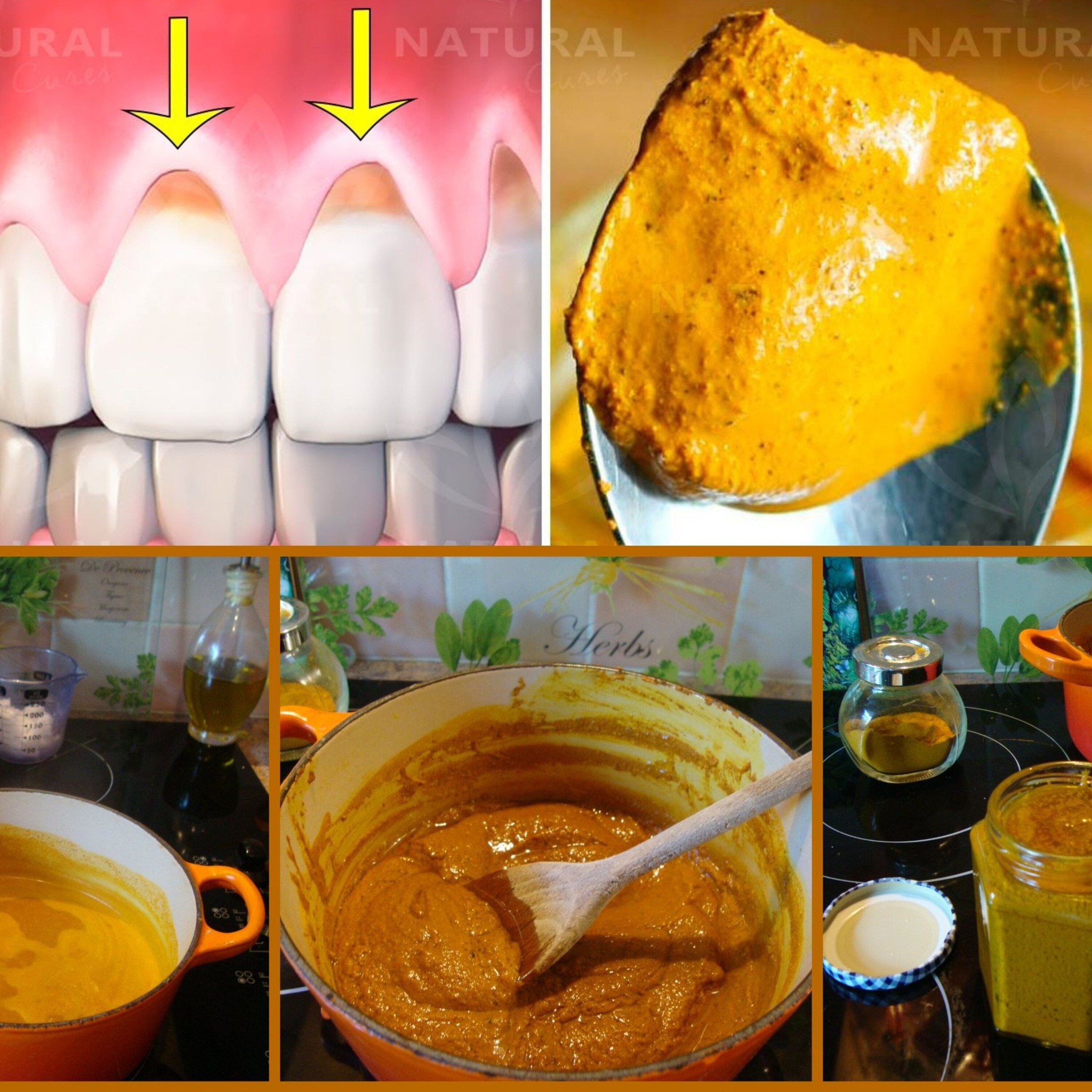 Why Turmeric is Fantastic for Oral Health and Hygiene