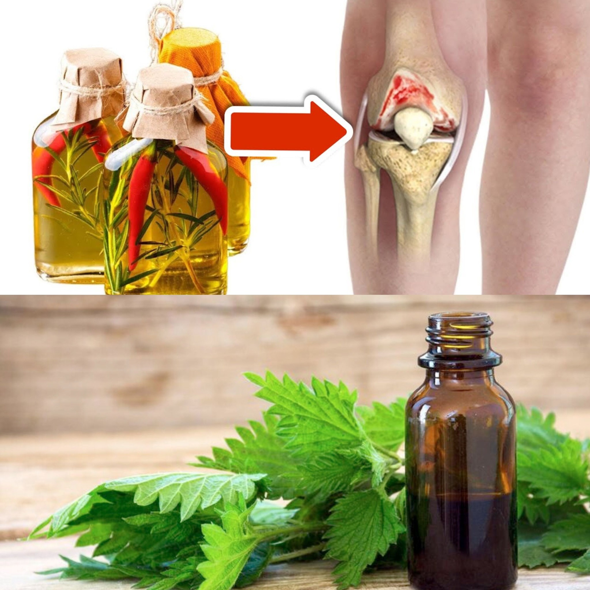 Nettle Oil: A Natural Solution for Reducing Knee Swelling and Pain