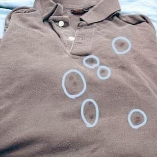 How to remove set-in grease stains from laundry