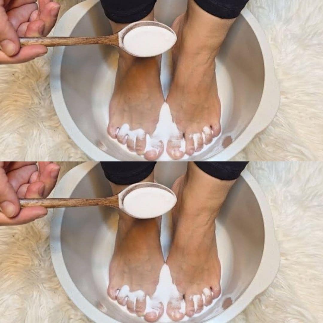 I put baking soda on my feet and look what happened !