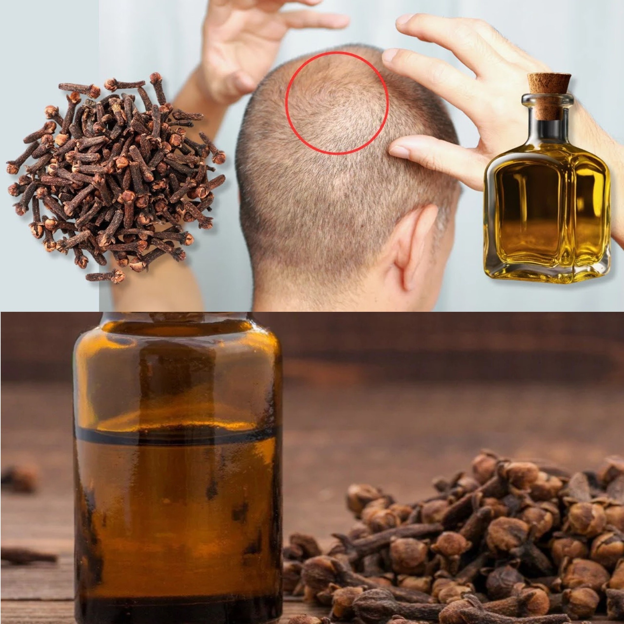 At 75, Hair Grows on a Bald Spot! How Clove Oil Can Stimulate Hair Growth