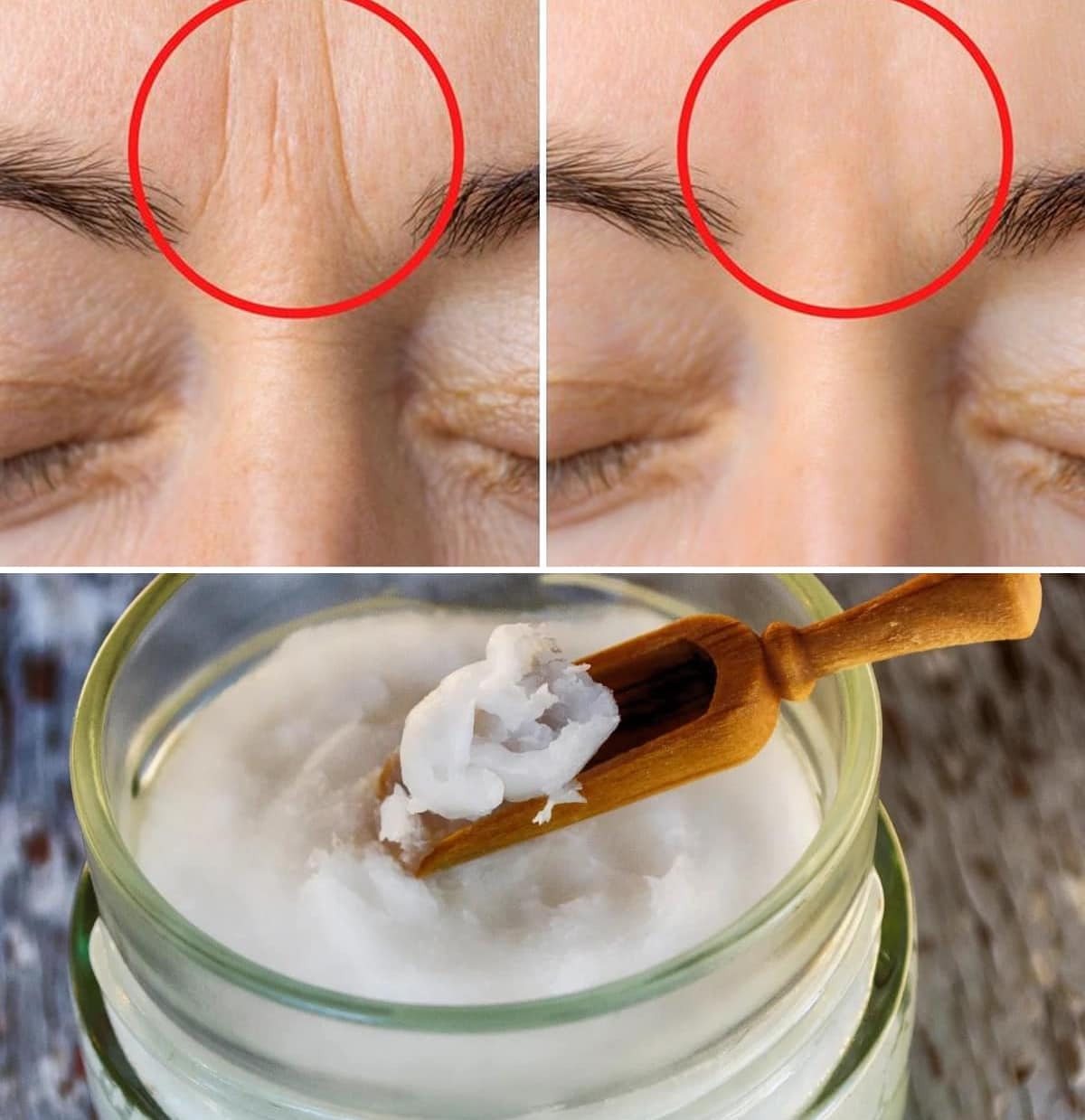 2 Masks to Eliminate Wrinkles Between the Eyebrows