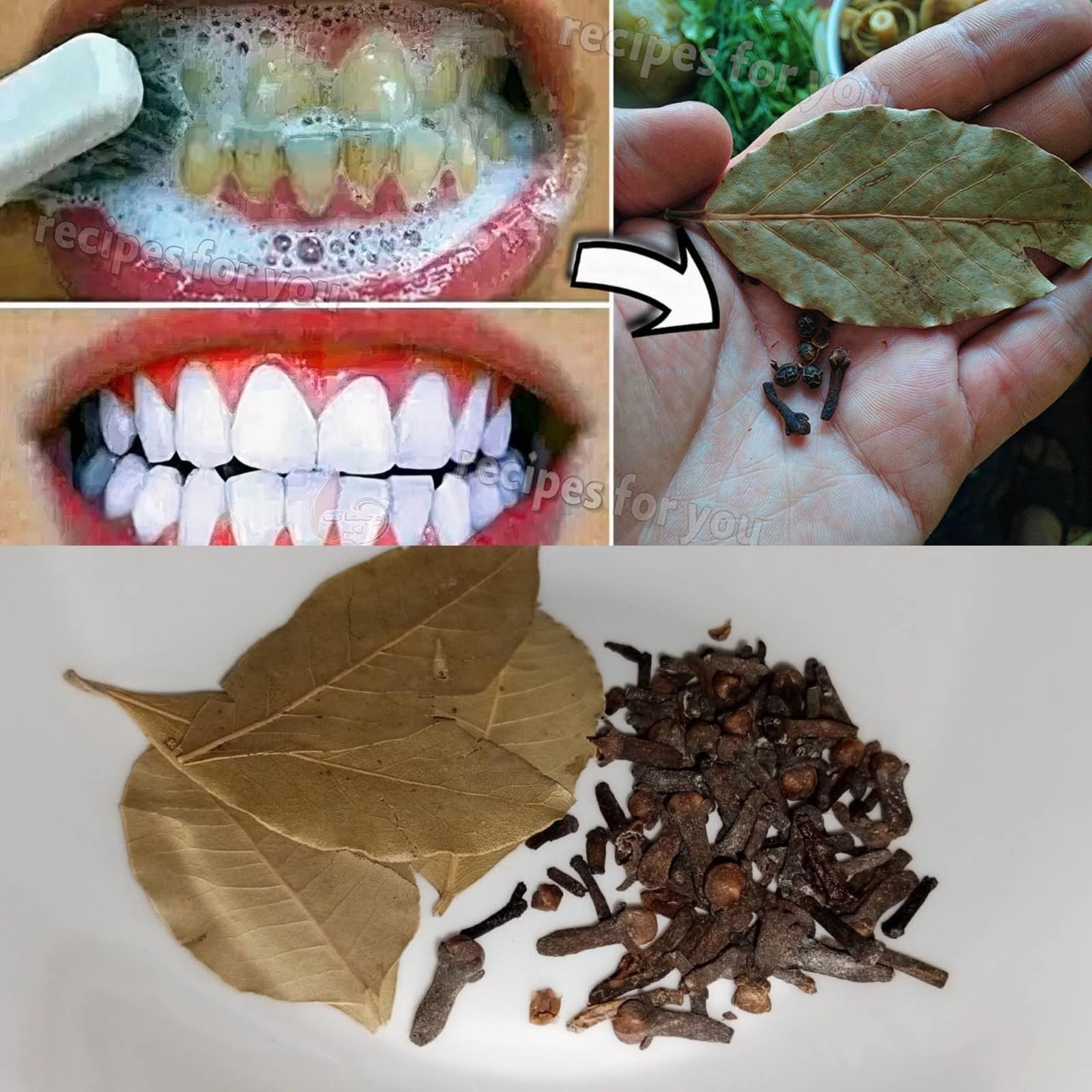 Whitening Teeth Naturally with Bay Leaves and Cloves: A Dental Tip