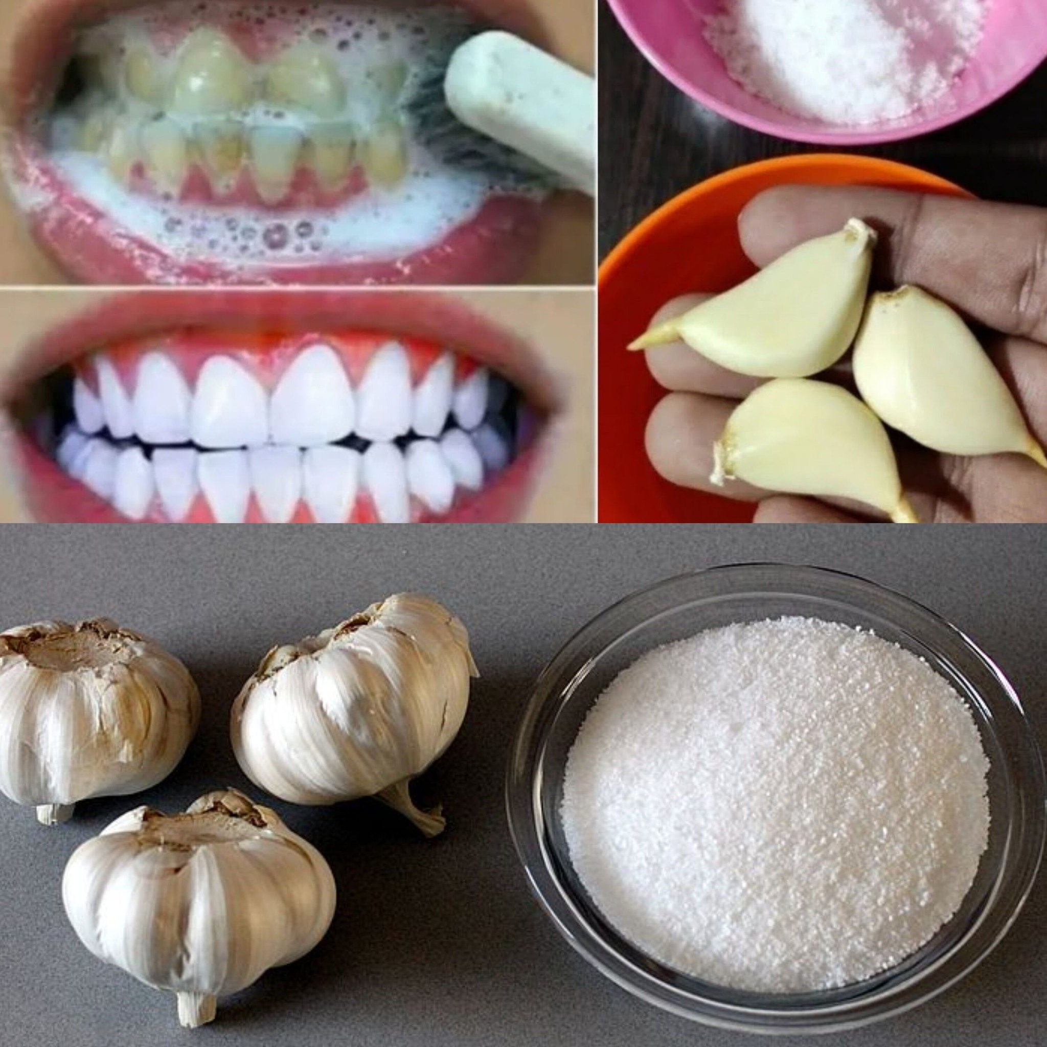 Teeth Whitening at Home in 2 Minutes! Naturally Whiten Yellow Teeth with Garlic & Salt (100% Effective!)