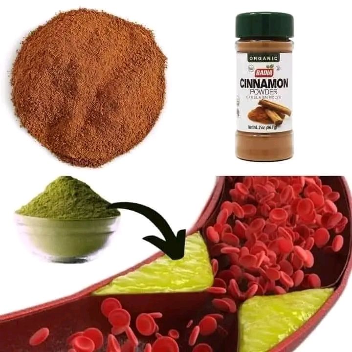 Take 1 Spoon Daily and Clean Your Blood Vessels, Prevent Heart Attack and Stroke! Cinnamon