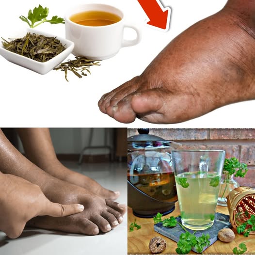 The Power of Parsley Tea: Natural Relief for Swelling in Legs, Ankles, and Feet