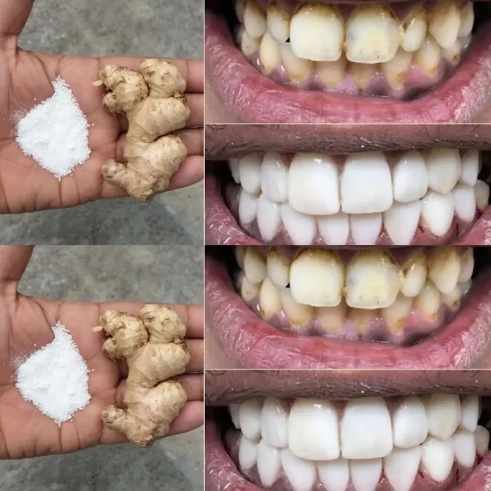 Whiten Your Teeth in 2 Minutes – Home Remedy with Ginger & Salt