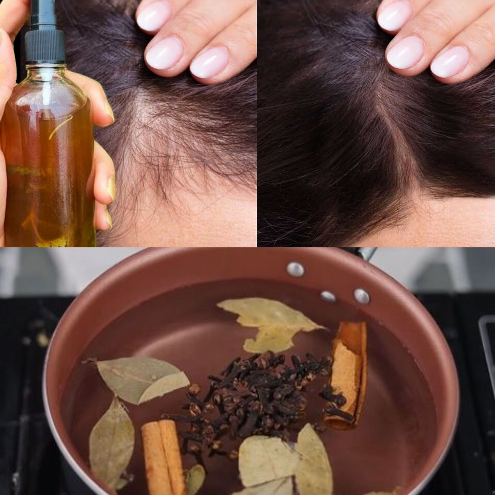 Mix These 3 Ingredients for Faster Hair Growth & to Stop Hair Loss – A Powerful Natural Remedy