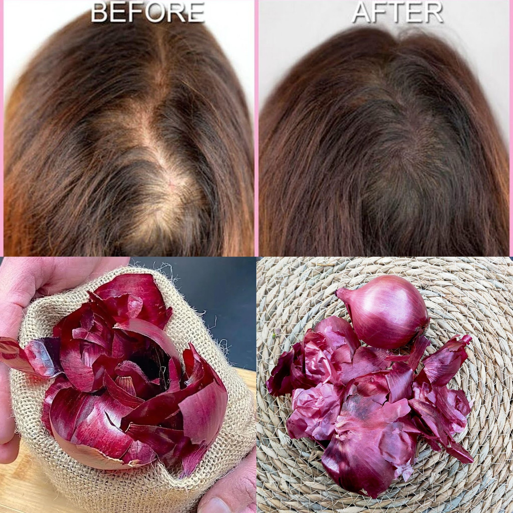 Onion Peel Remedy: Hair Growing Like Crazy in 14 Days!